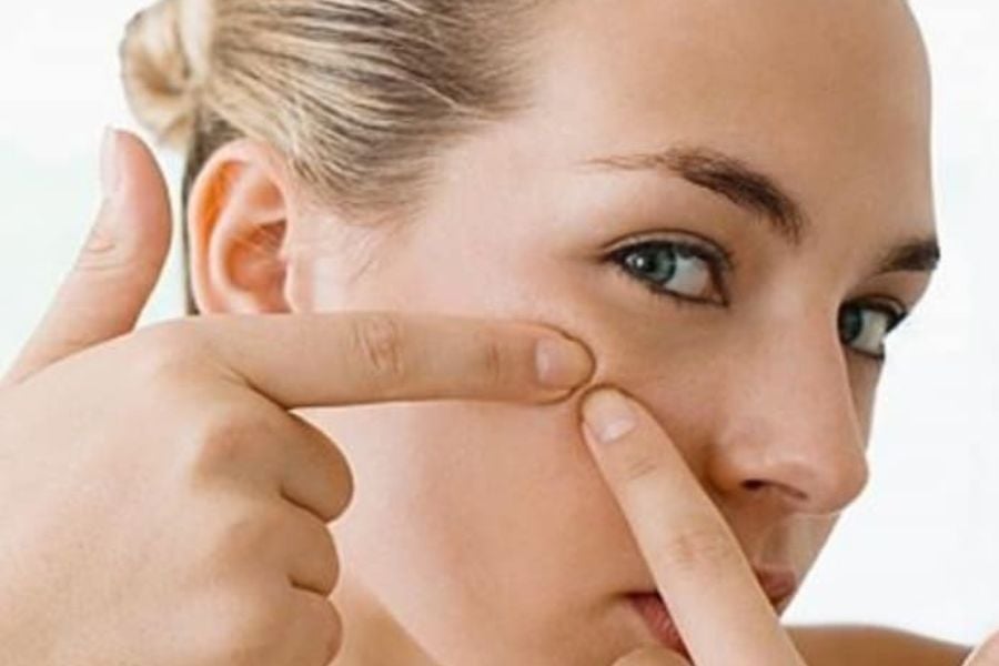 Những sai lầm khi trị mụn khiến tình trạng mụn trầm trọng hơn