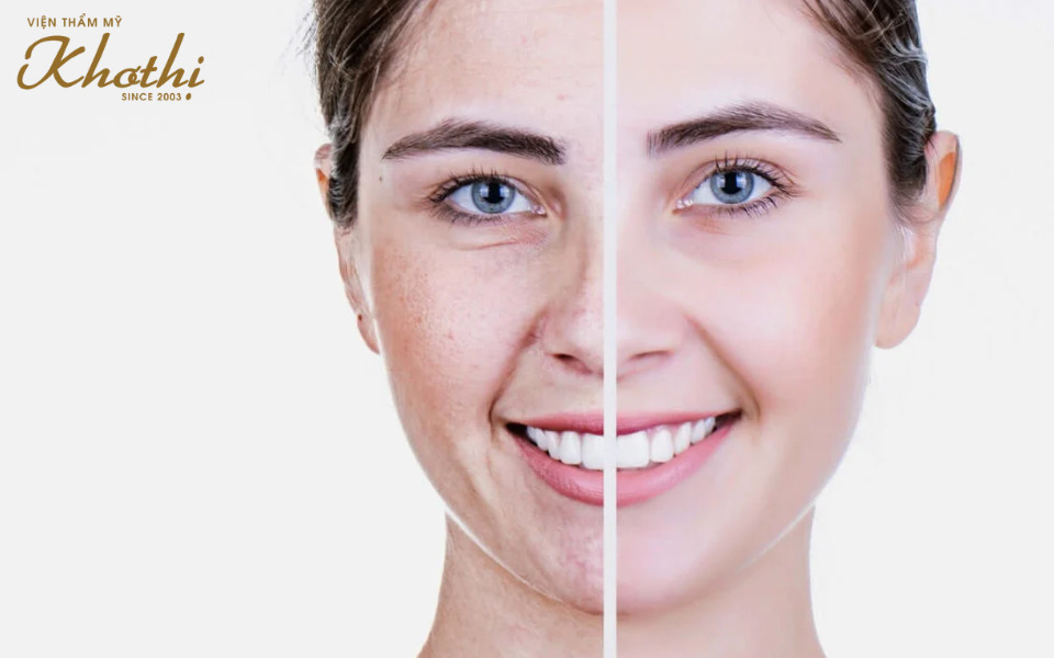 Elastin Matrix 8D Khơ Thị