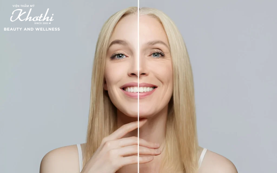 elastin matrix 8d và tiêm botox