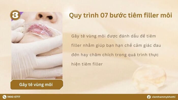 Gây tê môi bằng Lidocaine là loại phổ biến, được sử dụng nhiều trong các cơ sở thẩm mỹ hiện nay
