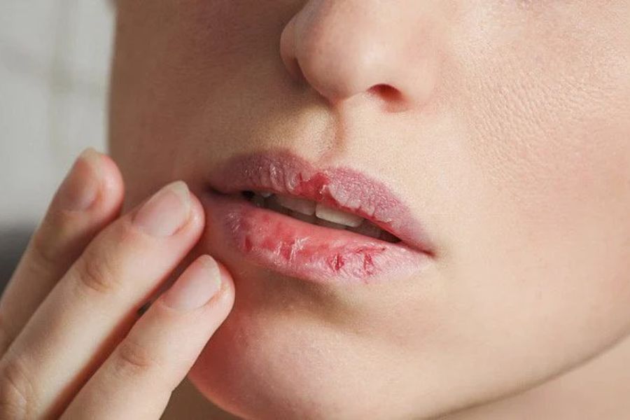 Cơ thể ất nước gây mệt mỏi, chán nản