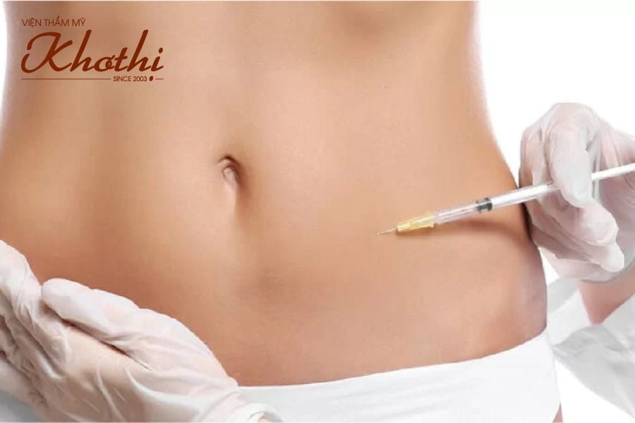 Phương pháp tiêm tan mỡ Mesotherapy loại bỏ mỡ dưới da