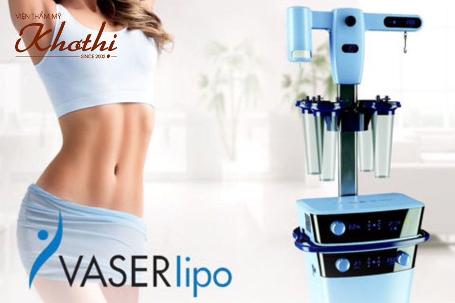 giảm cân ở na giới bằng công nghệ vaser lipo