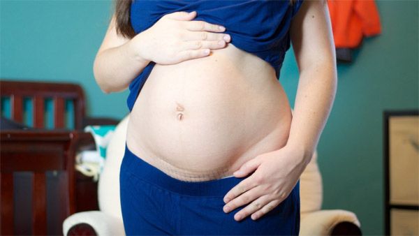 Việc giảm cân sau sinh là mục tiêu của nhiều chị em, kể cả sinh thường và mổ bụng chảy xệ sau sinh