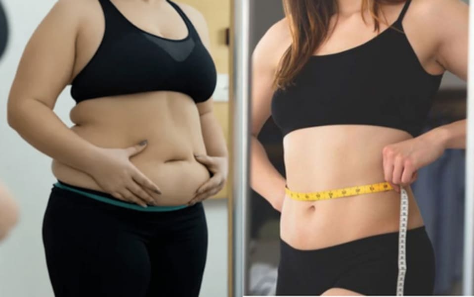 Giảm mỡ bụng không phẫu thuật