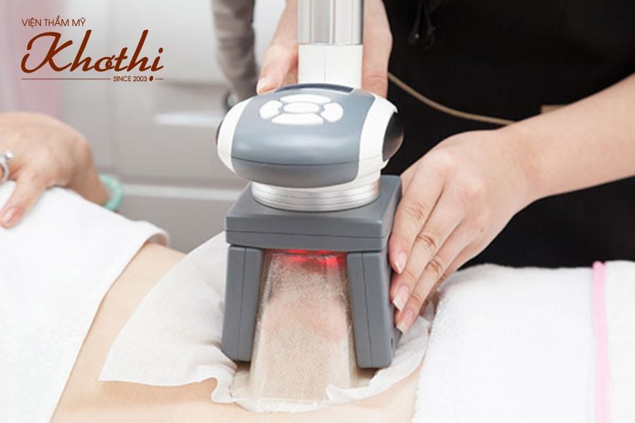 Phương pháp giảm mỡ bằng công nghệ nhiệt lạnh đông hủy mỡ Coolsculpting