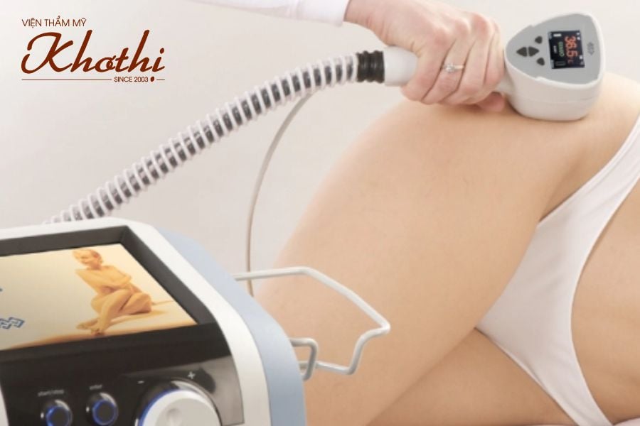 Công nghệ laser hủy mỡ có gì hot