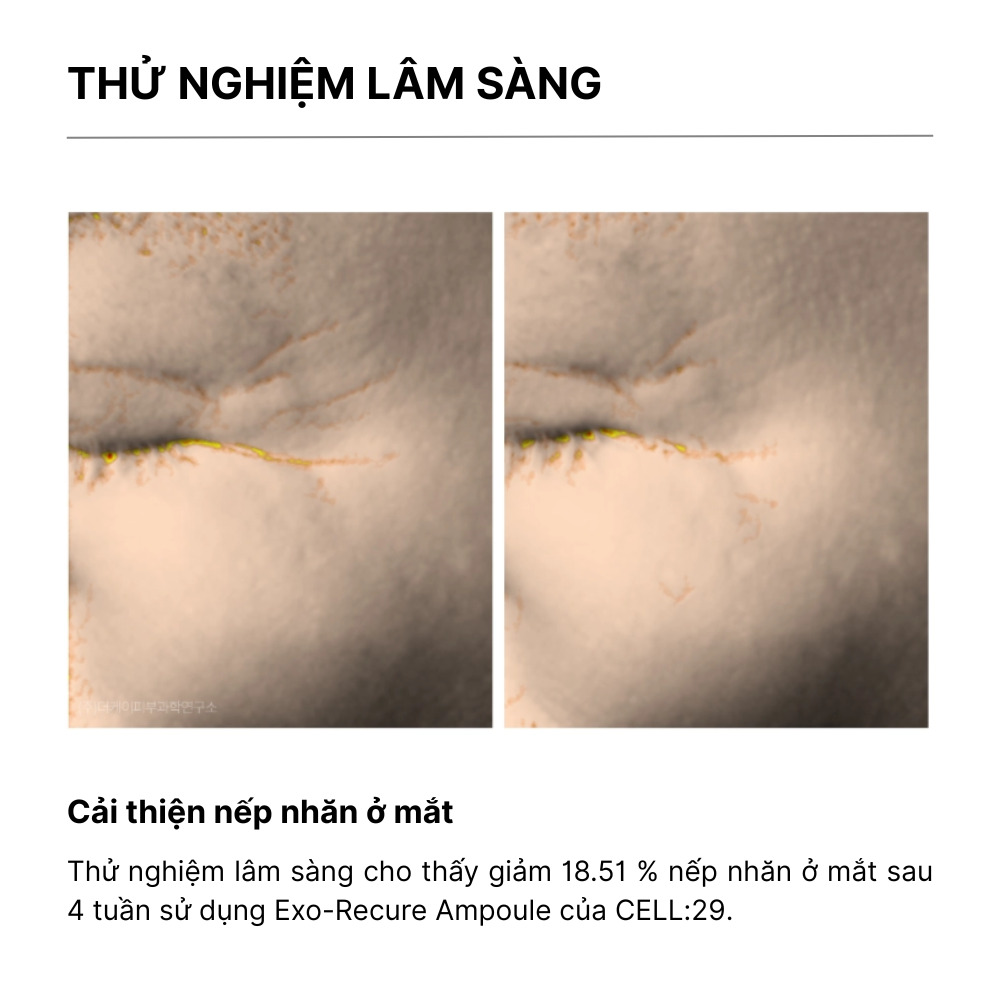 thử nghiệm lâm sàng cell29 exo-recure ampoule