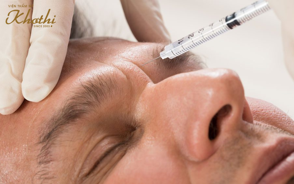 hiệu quả của tiêm botox