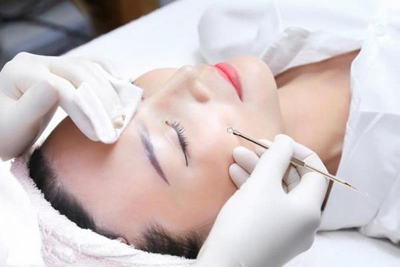 Điều trị mụn y khoa