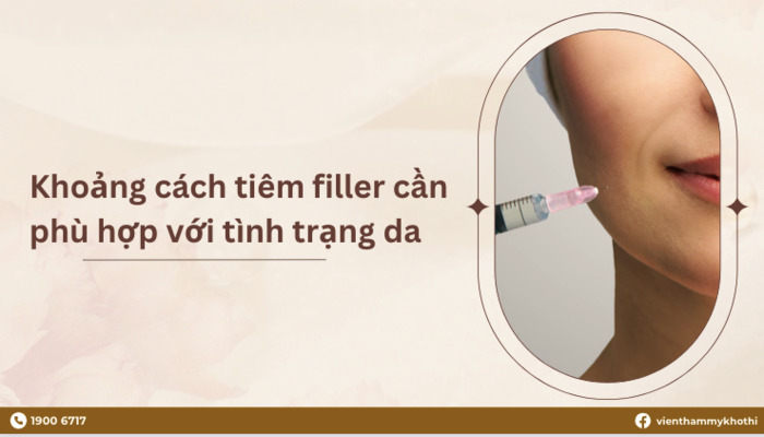 Thời gian lý tưởng đến tiêm filler lần tiếp theo là 1 năm sau lần tiêm trước