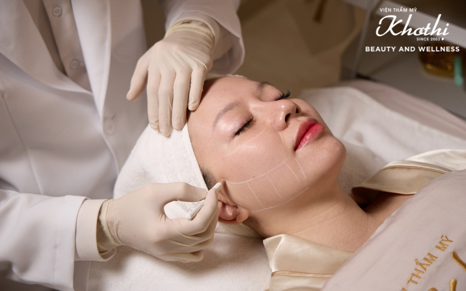 phương pháp thẩm mỹ ultherapy