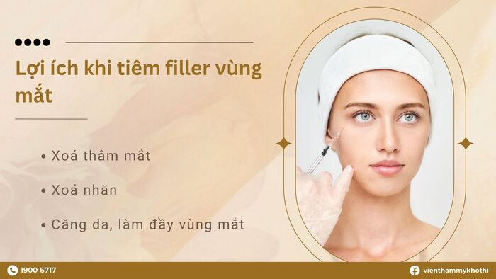 Lợi ích thu được từ việc tiêm filler vùng mắt