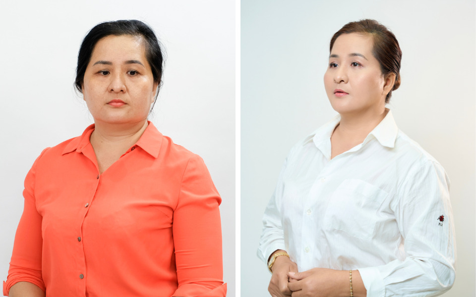 làm elastin matrix 8d khơ thị có đau không