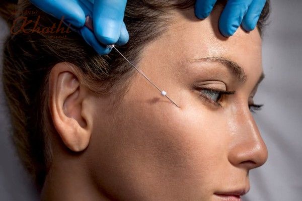 Thực hiện các thủ thuật nâng cơ mặt bằng chỉ