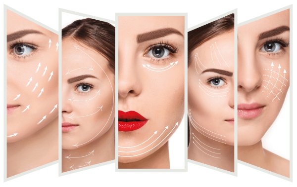 Nâng cơ mặt bằng chỉ collagen