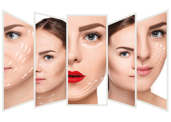 Nâng cơ mặt bằng chỉ collagen có hiệu quả cao