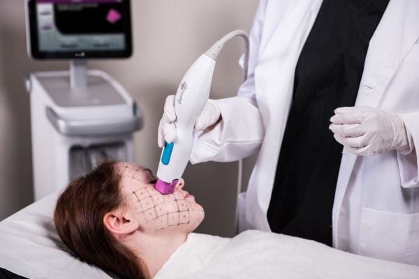 Máy Thermage FLX với nhiều ưu điểm