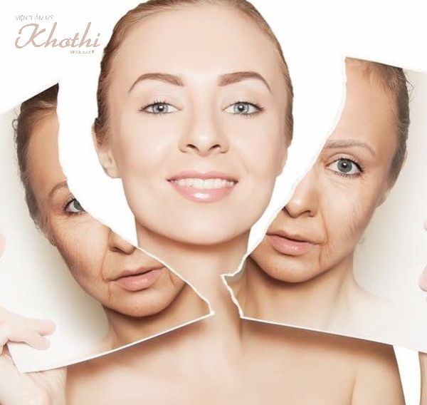 Nâng cơ mặt phẫu thuật sẽ đưa các nét trên khuôn mặt về lại vị trí khi còn trẻ.