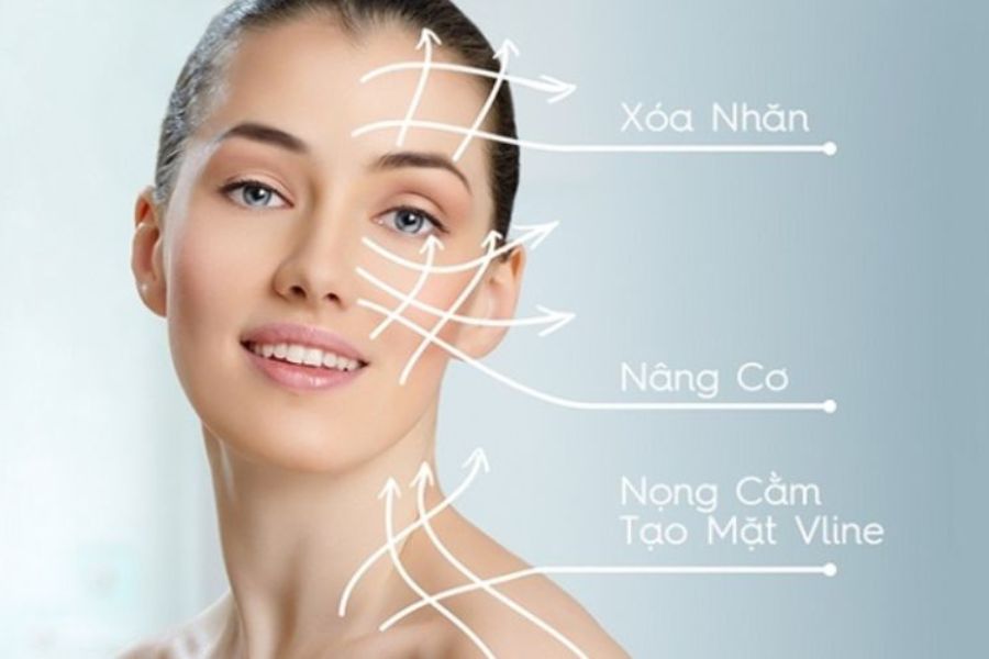 Nâng cơ xóa nhăn gương mặt trẻ trung tươi tắn