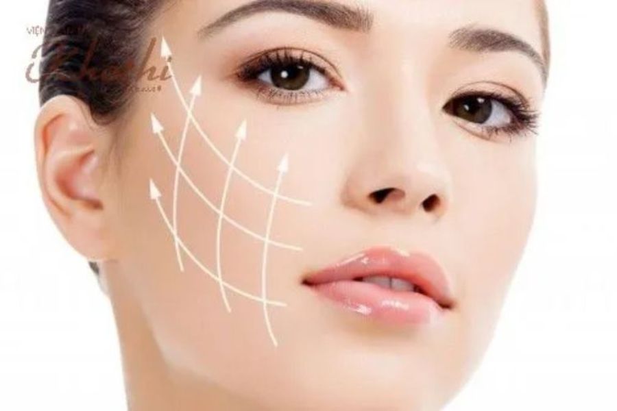 Nâng cơ trẻ hoá Khơ Thị