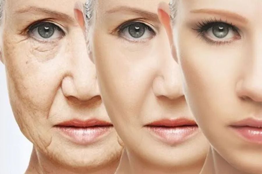 Nâng cơ trẻ hoá Khơ Thị