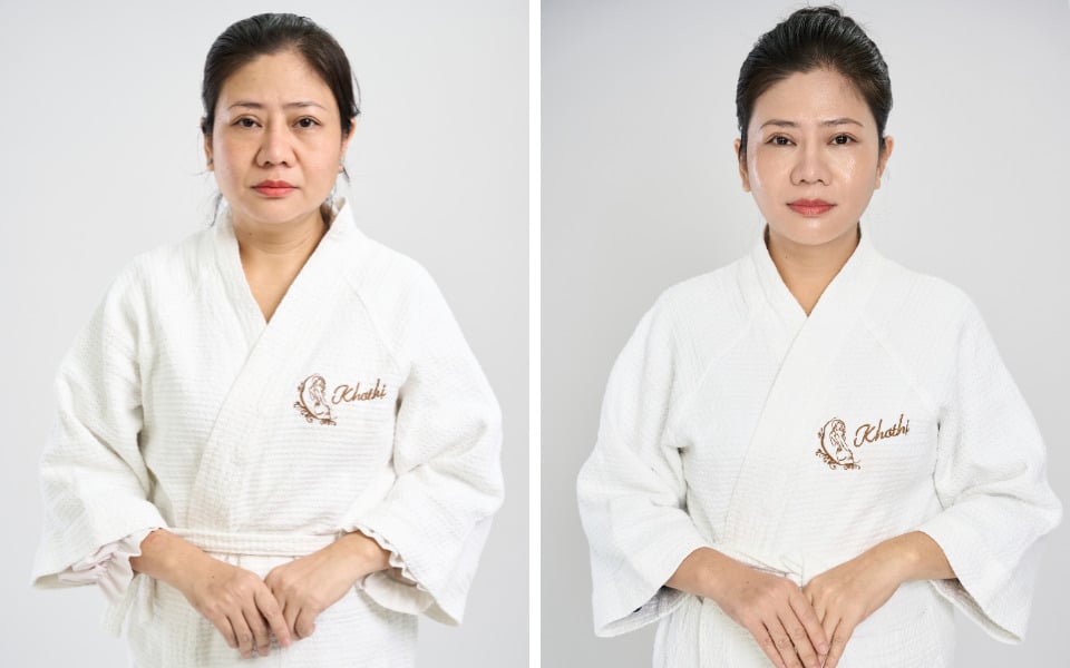 nâng cơ khơ thị