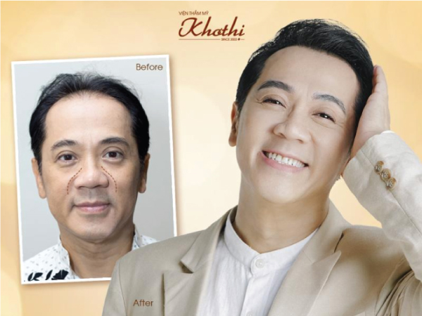 Phẫu thuật tại viện thẩm mỹ Khơ Thị