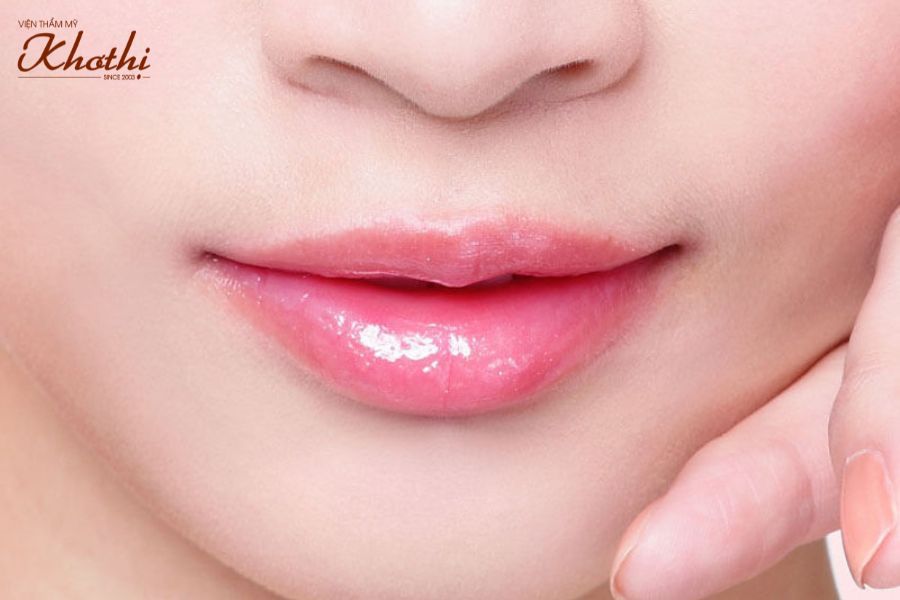 phẫu thuật thẩm mỹ môi Khơ Thị