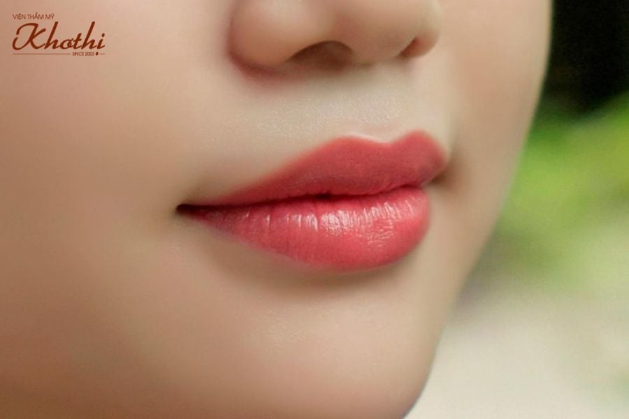 phẫu thuật thẩm mỹ môi Khơ Thị
