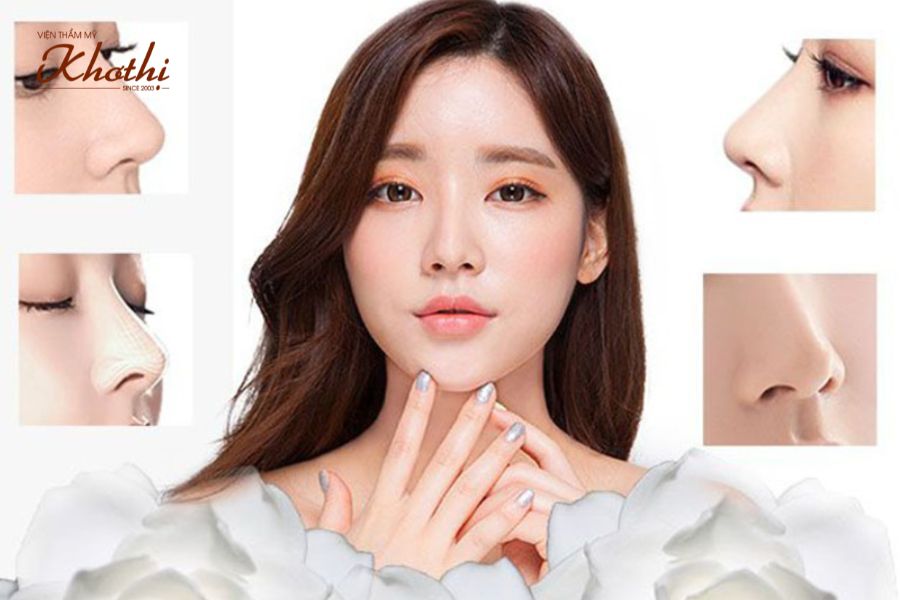Phẫu thuật thẩm mỹ mũi Khơ Thị