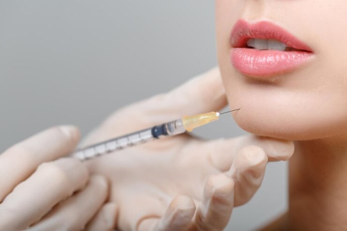 Quá trình tiêm filler cằm hầu như không mang lại cảm giác đau đớn.