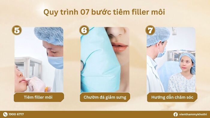 Quy trình tiêm filler môi cơ bản ai cũng cần/ nên biết