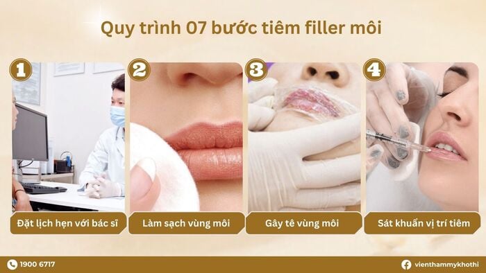 Quy trình tiêm filler môi cơ bản ai cũng cần/ nên biết 