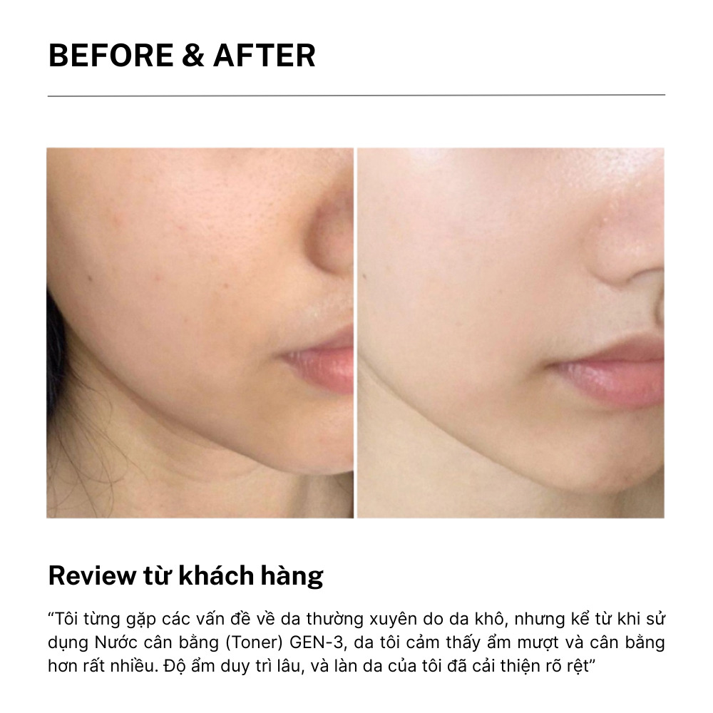 review toner gen3 cell29