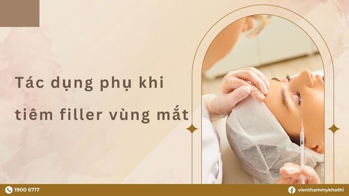 Một số tác dụng phụ khi thực hiện tiêm filler vùng mắt