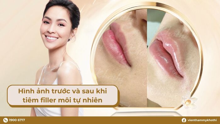 Tạo hình môi trái tim giúp đôi môi trông quyến rũ hơn, song vẫn giữ được nét tự nhiên vốn có