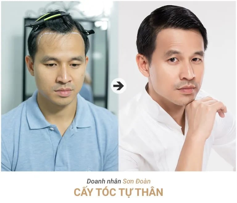 Thẩm mỹ viện Khơ Thị bảng giá