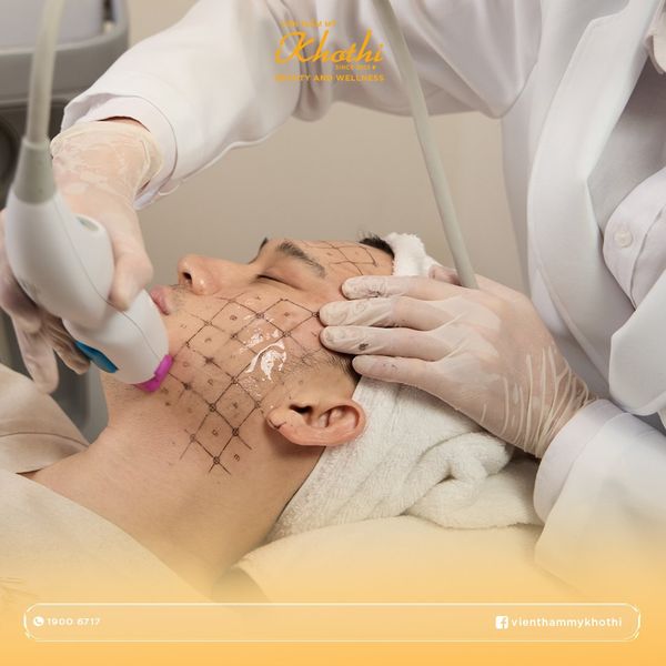 thermage khơ thị