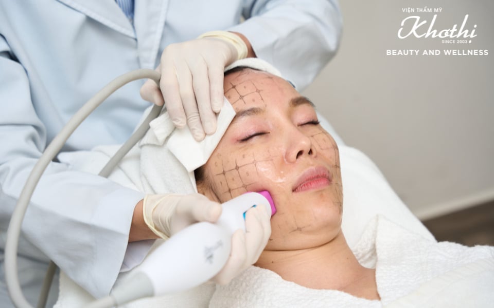 thermage flx làm đẹp da