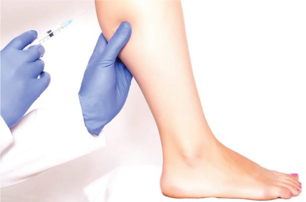 Tiêm Botox