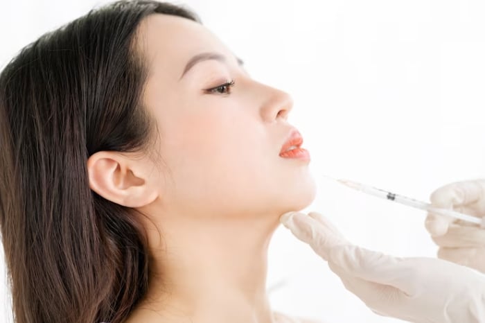 Tiêm filler cằm có mang lại vẻ đẹp tự nhiên không phụ thuộc vào nhiều yếu tố.