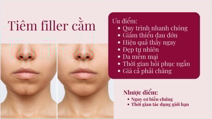 7 điểm mạnh và 2 hạn chế phương pháp tiêm filler.