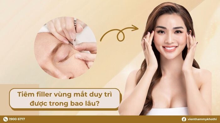 Tiêm filler mắt có thể duy trì được trung bình khoảng 1-2 năm