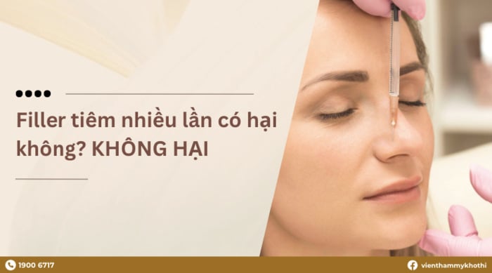 Tiêm filler nhiều lần không gây hại nếu khoảng thời gian giữa 2 lần tiêm được sắp xếp hợp lý