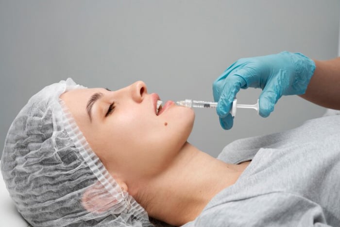 Tiêm Hyaluronidase là cách làm tan filler môi được áp dụng phổ biến nhất hiện nay.