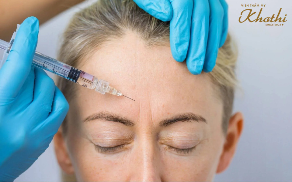 tiêm botox khơ thị