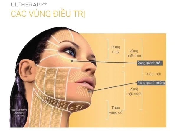 Ultherapy là một trong những công nghệ nâng cơ mặt, trẻ hóa da hàng đầu trên thế giới. Ultherapy là một trong những công nghệ nâng cơ mặt, trẻ hóa da hàng đầu trên thế giới.