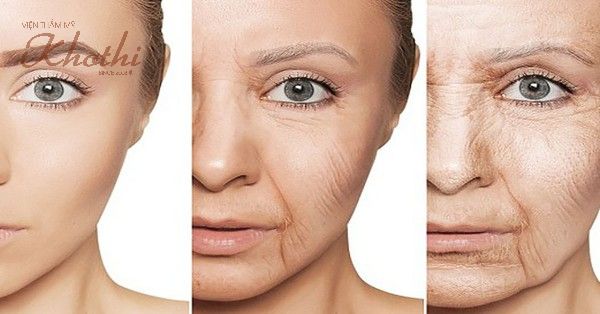 Trẻ hóa da bằng ánh sáng