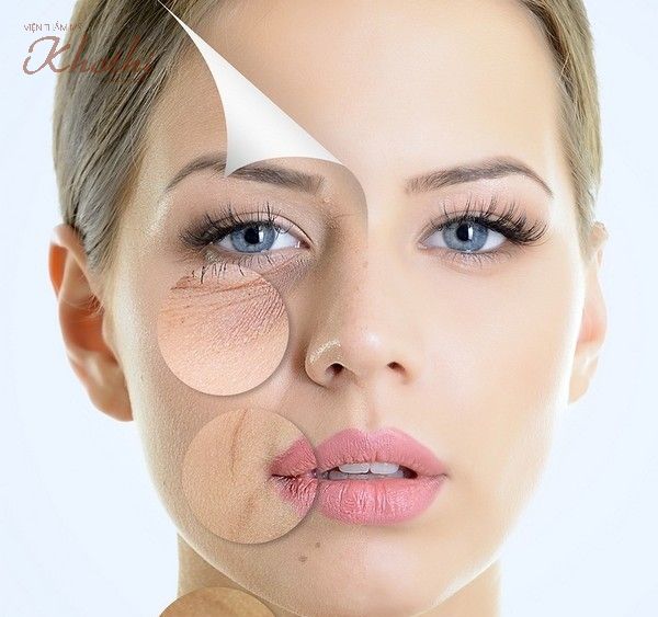 Trẻ hóa da bằng ánh sáng giúp giảm nếp nhăn hiệu quả